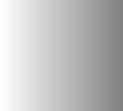 Endokrynologia Polska / Polish Journal of Endocrinology 5; 5 (5) Materiał i metody Zebrany materiał to 5 osób z hiperprolaktynemią i BB-PRL jako formą dominującą.