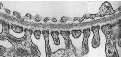 śródbłonkowych (z okienkami) błona