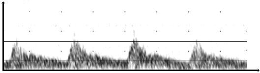 Folia Cardiol. 2002, tom 9, nr 2 Materiał i metody Badana grupa. Zbadano 40 mężczyzn w wieku 28 87 lat, których podzielono na dwie 20-osobowe grupy: osoby młodsze poniżej 55 rż.