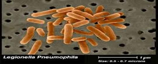 Legioneloza - postać płucna (choroba legionistów) Jest typem ciężkiego zapalenia płuc, wywołana przez Legionella pneumophilla. Zgodnie z Ustawą z dnia 5 grudnia 2008r.