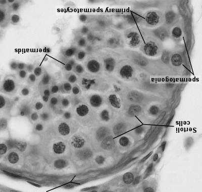 dojrzewające plemniki spermatocyty I rzędu spermatocyty II rzędu kom.sertolego spermatocyty I rzędu A jasne A ciemne sp. I rzędu kom.