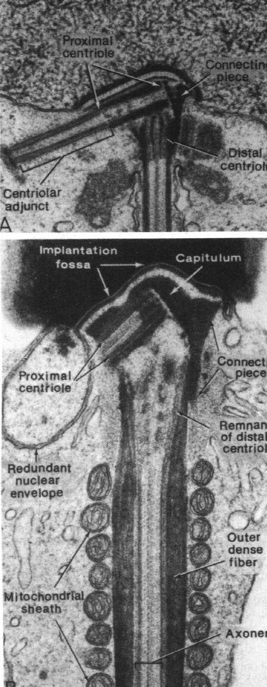 centriole otoczone część przez 9 kolumn końcowa białkowych - część pośrednia