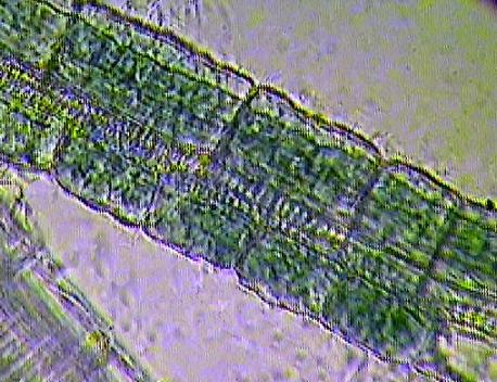 spektrofotometria, luminometria, fluorometria), HPLC - oznaczenia aktywności enzymów, zawartości metabolitów, ATP i ADP itd Izolowane pochwy okołowiązkowe