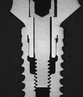 IMPLANT FLEXIBILITY Portfolio implantów Straumann oferuje elastyczne rozwiązania dla każdego przypadku. Teraz to bez znaczenia jak trudny lub wymagający może być następny pacjent.