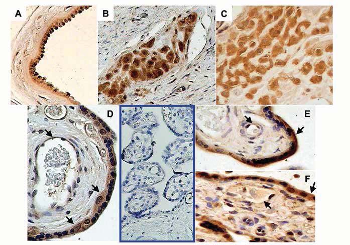 P R A C E O R Y G I N A L N E Ginekol Pol. 2014, 85, 410-419 Figure 2. MDR3 immunolocalization in normal and GDM human placentas at term.