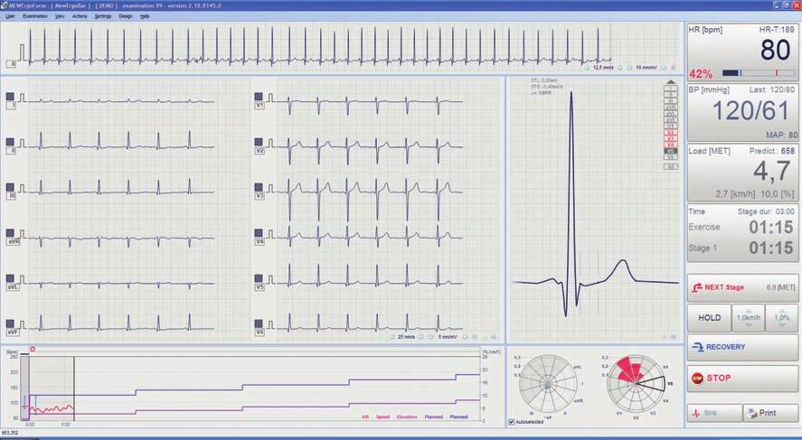 PróBY WYSiŁKOWE 15 BTL CArDiOPOiNT-ErGO systemy do PróB WysiŁKOWyCH Oprogramowanie BtL CardioPoint-ErGO wyznacza nową erę w dziedzinie systemów do prób wysiłkowych.