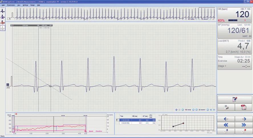PróBy WysiŁKOWE 17 BTL CardioPoint-ErGO OBrAZOWANiE MODuŁu QT MOduŁ Qt Moduł Qt jest unikalnym narzędziem służącym do analizy ryzyka nagłej śmierci z powodu wystąpienia zespołu długiego Qt.