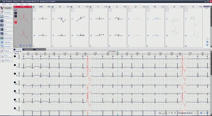 HOLTErY EKG 19 BTL CArDiOPOiNT-HOLTEr 3, 7, 12-KANAŁOWE systemy HOLtErOWsKiE Holter umożliwia rejestrację sygnału z 3, 7 lub 12 kanałów EKG w czasie od 1 do 7 dni.