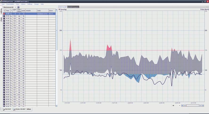 HOLTEr CiśNiENiA KrWi 23 BTL CArDiOPOiNT-ABPM MONitOriNG CiśNiENiA KrWi do 51 GOdZiN BtL CardioPoint-ABPM to nieinwazyjny rejestrator ciśnienia krwi.