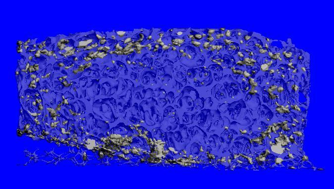 Surface Treatment of Cell Tissue Scaffolds as Analysed by the Axis Ultra DLD Simon Hutton, Kratos Analytical, The following example has been kindly provided by Prof.