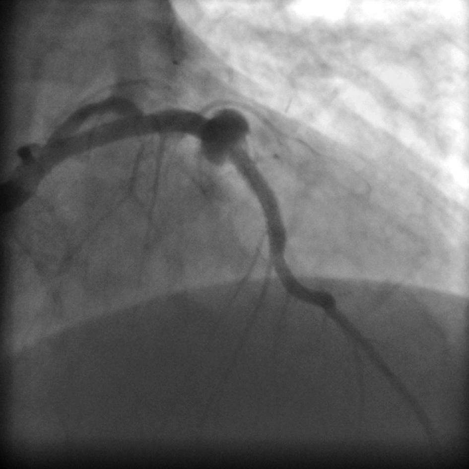 examination). The patient was discharged 7 days after the procedure.