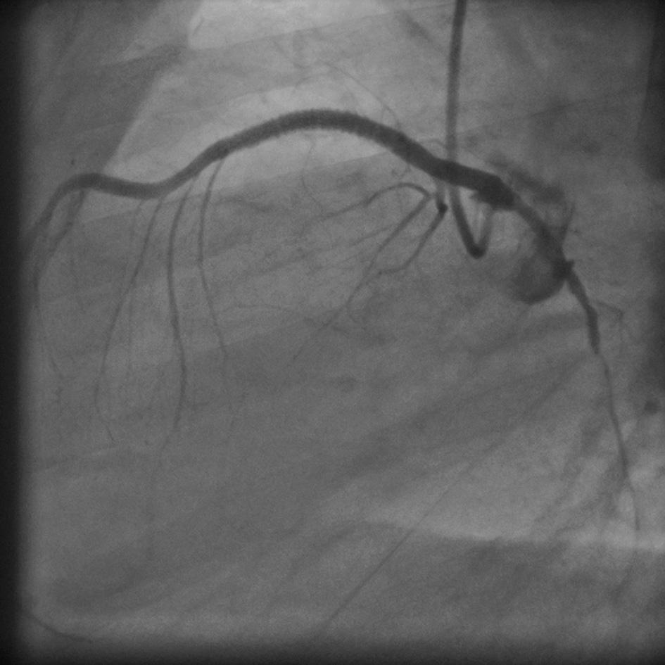 cardiac surgery are to be considered [6, 7].