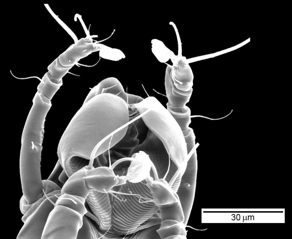 Wybrane zagadnienia z biologii 107 Rysunek 75. Afrolistrophorus (A.) apodemi Fain, 1970 (Listrophoridae Astigmata).
