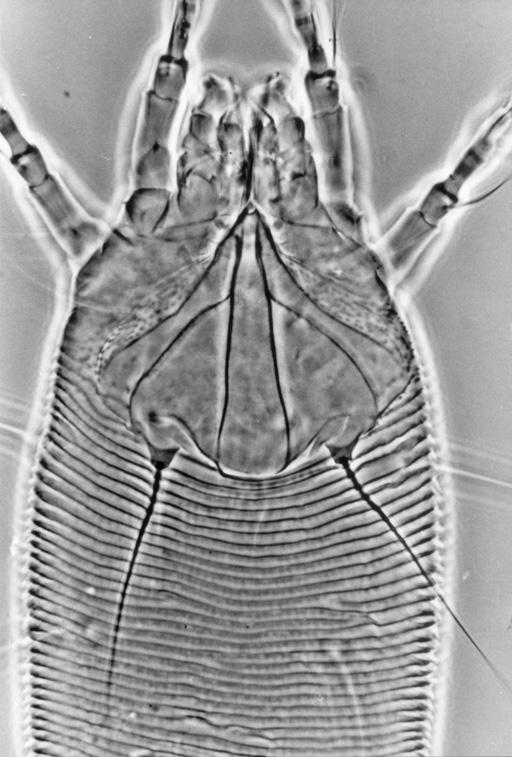 Znaczenie roztoczy w życiu i gospodarce człowieka 171 Rysunek 93. Aculodes dubius (Nalepa, 1891) (Eriophyidae Prostigmata).