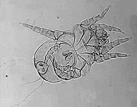Euroglyphus maynei (Pyroglyphidae Astigmata).