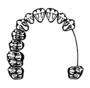 Umiejętność 6) rozróżnia i charakteryzuje cechy łuków zębowych i klasyfikacje braków uzębienia, na przykład: rozróżnia cechy łuków zębowych; np.