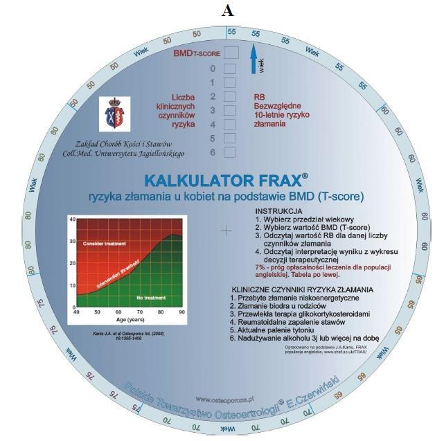 Kalkulator FRAX nowe narzędzie w diagnostyce osteoporozy