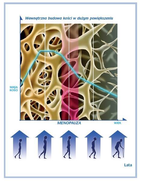 Jak zmienia się kość w ciągu życia? Kość jest żywą tkanką, ulegającą przeciwstawnym procesom przebudowy - tworzenia i niszczenia.