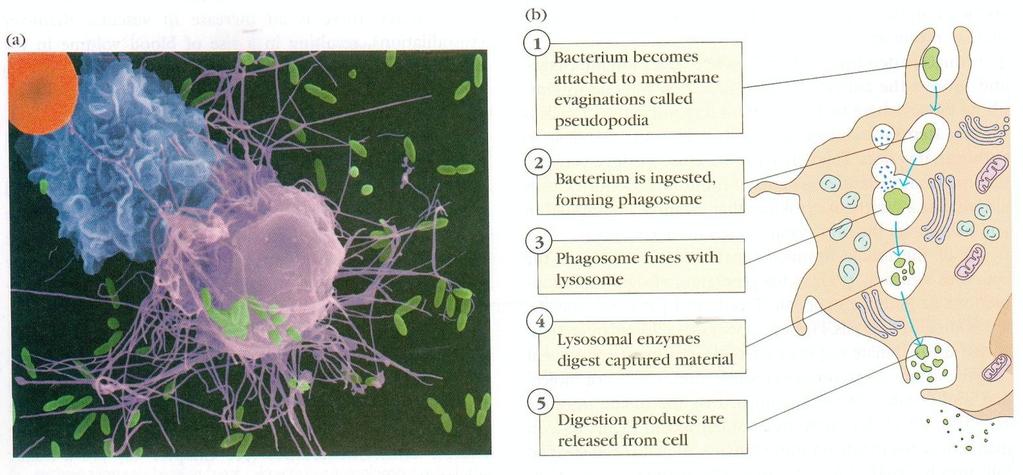 Większość zaburzeń dotyczy procesu fagocytozy Zaburzenia komórek żernych mogą powodować zakażenia skóry i