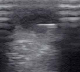embrionalne komórki macierzyste (ESCs, ang. Embryonic Stem Cells) wyprowadzone z komórek embrionalnych.