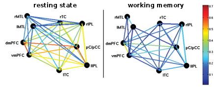 Default mode network Silna negatywna korelacja PCC z obszarami zorientowanymi zadaniowo Bardzo istotna rola PCC