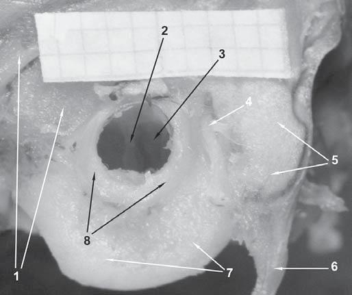 154 Otorynolaryngologia, 2005, 4(3), 153-158 morskiej, stanowi próbê wype³nienia tej luki, tym bardziej, e prac poœwiêconych temu gatunkowi jest stosunkowo niewiele [6-11].