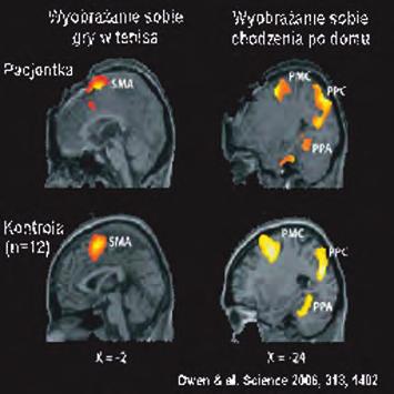 Z początkiem 2003 roku Rada Bezpieczeństwa ONZ stanowczo potępiła przypadki kanibalizmu w czasie masakr wywołanych przez żołnierzy Ruchu Oswobodzenia Kongo (MLC) w Republice Demokratycznej Konga.