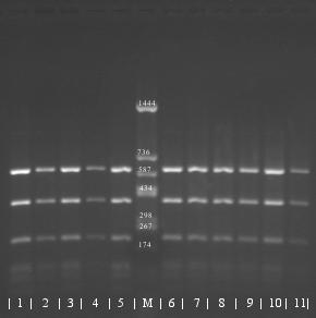 Amplifikację przeprowadzono w mieszaninie reakcyjnej HotStarTaq Plus Master Mix (QIAGEN) zawierającej: 1u polimerazy DNA HotStarTaqPlus, 1x bufor PCR z 15mM MgCl 2, po 200 μm mieszaniny dntp, 1x