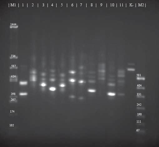 szczepy pod względem różnic w obszarze pomiędzy genami 16S rrna 23S rrna. Po amplifikacji regionu zmiennego ITS w wyniku elektroforezy otrzymano wieloprążkowy profil elektroforetyczny (Ryc.3).
