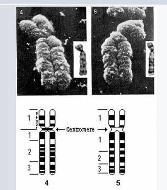 Chromosom metafazowy Chromatydy