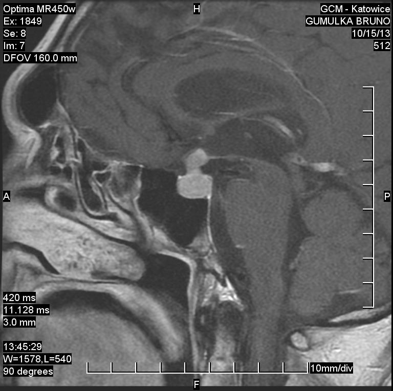 Obraz MRI