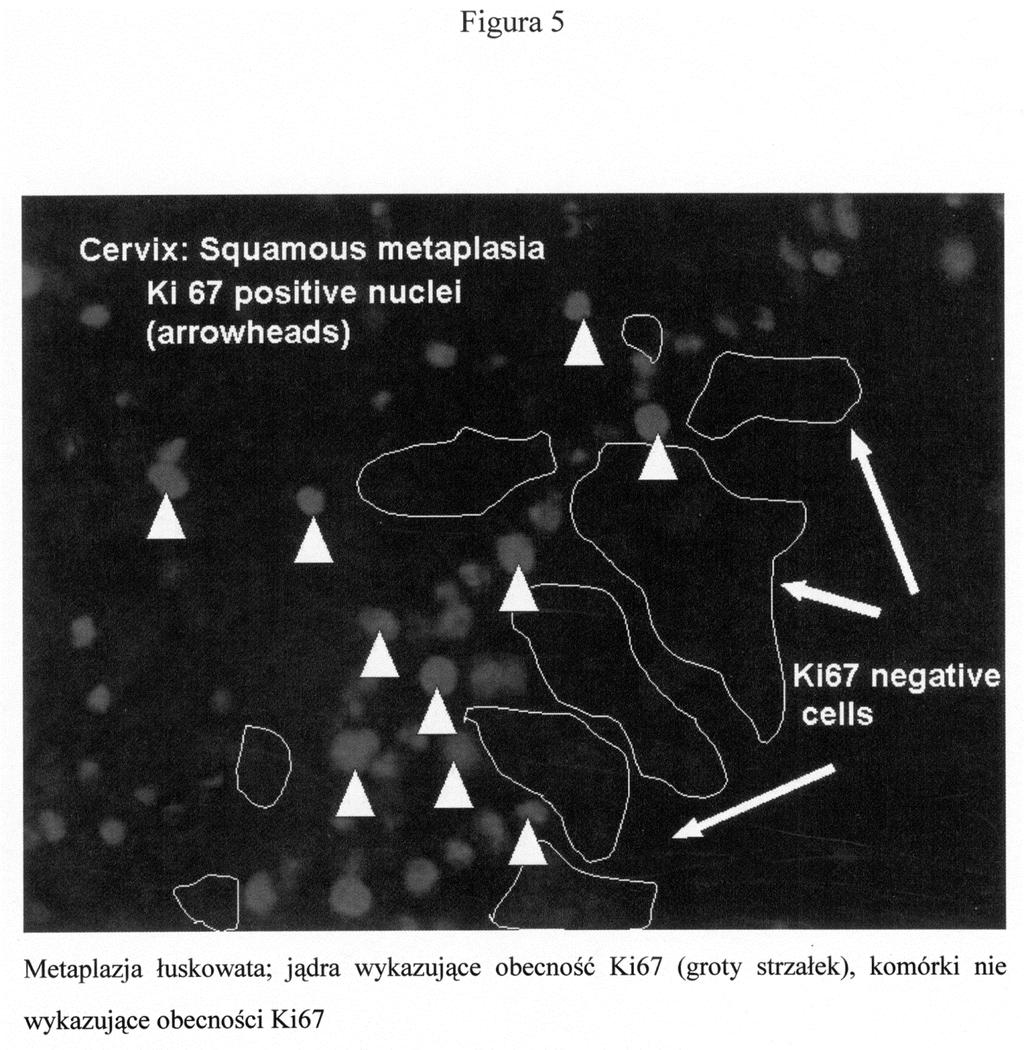 PL 214