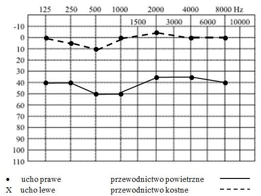 Przykładowe zadanie 13. Na obrazie ultrasonograficznym jamy brzusznej uwidoczniono A. nerkę. B. trzustkę. C. wątrobę. D. śledzionę. Odpowiedź prawidłowa: C.