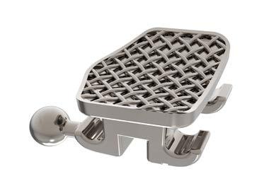 Nickel-Light alloy contain traces amounts of nickel, not exceeding 5%, so that brackets can be used on sensitive patients.