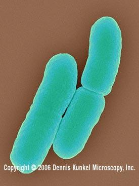 Rodzaj Escherichia Rodzaj Escherichia należy do Enterobacteriaceae tzn. rodziny pałeczek jelitowych. E. coli to bakterie gram-ujemne, nie zarodnikujące, na ogół ruchliwe, typowi mieszkańcy jelita grubego ludzi i zwierząt.