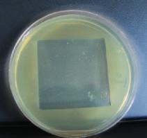 Bakterie Staphylococcus Aureus Escherichia Coli Pseudomonas Aeruginosa 2.