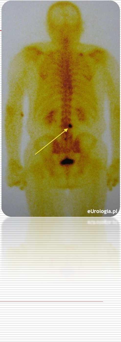 Emitowane promieniowanie (promieniowanie γ, pozytony) pozwala