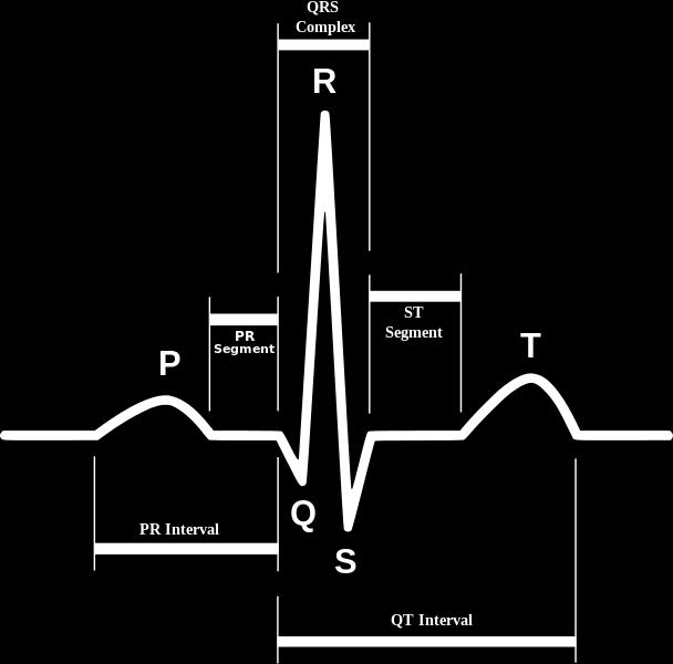 2 EKG - Elektrokardiografia Elektrokardiografia jest metodą graficznej rejestracji elektrycznej aktywności serca.
