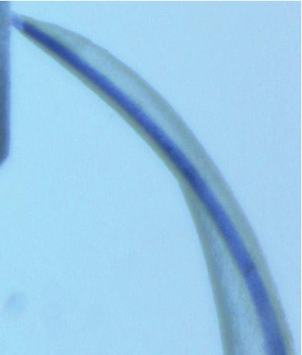 For comparison of the frequency of particular characteristic varieties in the study groups, the chi 2 test was applied.