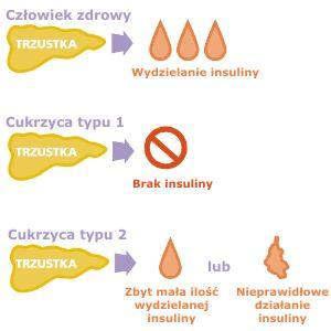 1. Opis problemu zdrowotnego a. Problem zdrowotny: Cukrzyca to grupa chorób metabolicznych charakteryzująca się hiperglikemią wynikającą z defektu wydzielania i/lub działania insuliny.