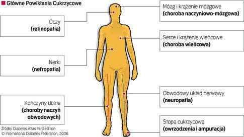 b. Epidemiologia: Raport dotyczący częstości występowania cukrzycy w poszczególnych regionach świata i w poszczególnych krajach przedstawia corocznie Międzynarodowa Federacja Diabetologiczna