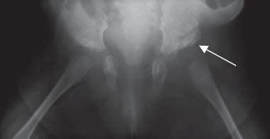 Suitability of imaging techniques in the diagnostics of ostitis in children own experiences 83 Table 1.