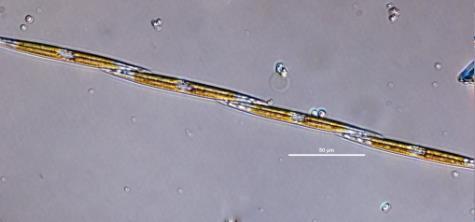 toksyny Asterionella (okrzemka) Zmienia
