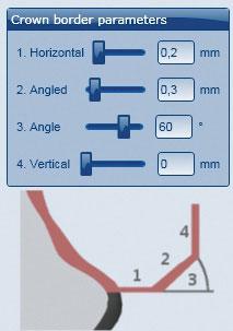 ZASTOSOWANIE Parametry krańcowe w oprogramowaniu CAD Stosując Ceramill Zolid Preshades należy zwrócić na to uwagę, aby parametry krańcowe zostały osiągnięte. Zalecane wartości to: _1.