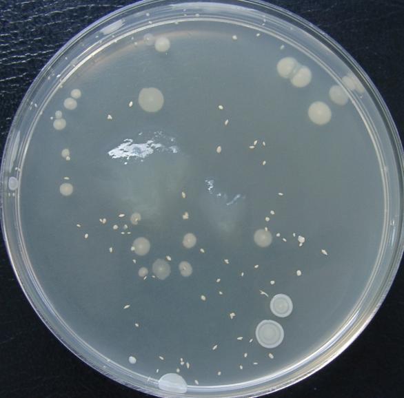 Fot. 1 Mieszanka bakterii