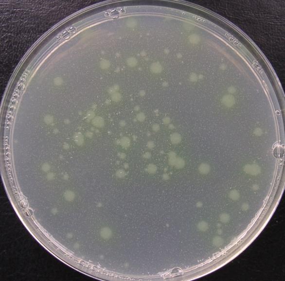 Fot. 3 Pseudomonas aeruginosa (ATCC