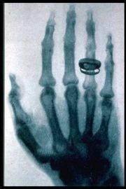 Jednak około 100 lat temu... 1895: X ray, W.