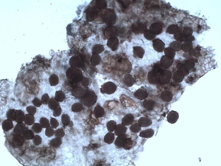 kwarantannowy Synchytrium endobioticum 55
