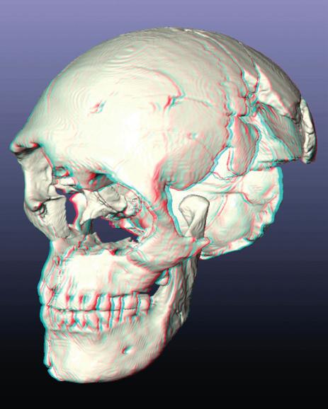Ryc. 13. Anaglifowy obraz przestrzenny czaszki wizualizacja 3D. Ryc. 14. Zestawienie obiektu rzeczywistego z komputerowym modelem 3D oraz wizualizacją foto-realistyczną.
