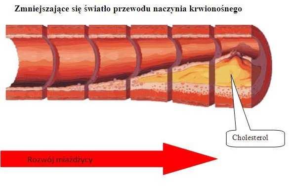 Modelowanie przepływu krwii w naczyniach krwionośnych miażdżycowo zmienionych 51 jest stała i wynosi µ=(3 4)*10-3 Pa s, co oznacza, że jest ona 3 4 razy większa od lepkości wody, przy czym spadek